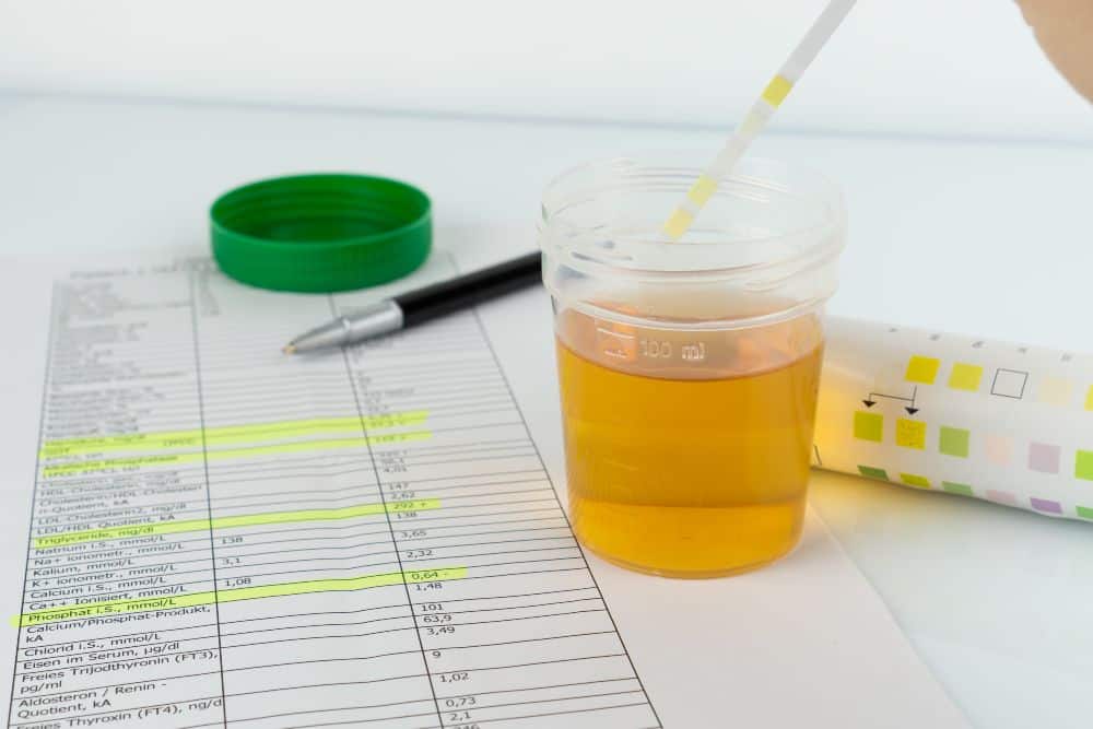 How Long Does Oxycodone Stay in Urine